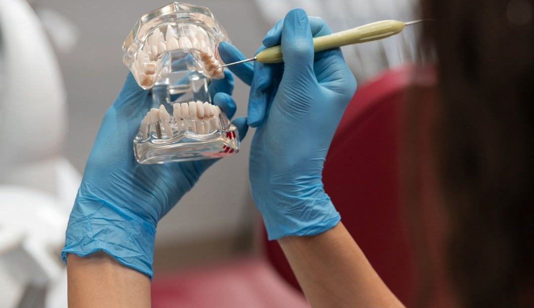 Implants dentaires numériques à Casablanca : Les avantages de la technologie CAO/DAO