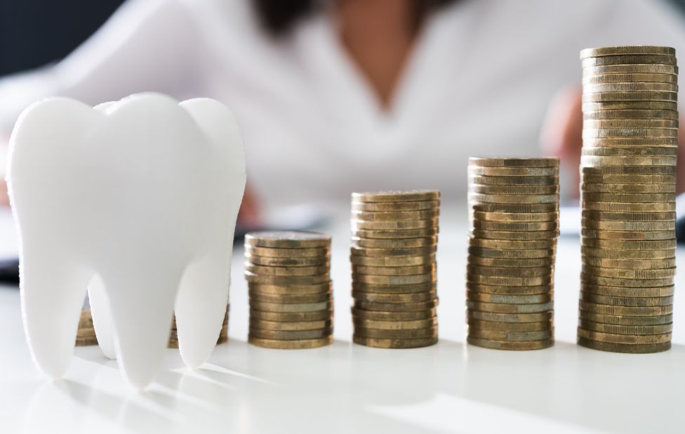 Délais et tarifs d’un implant dentaire à Casablanca