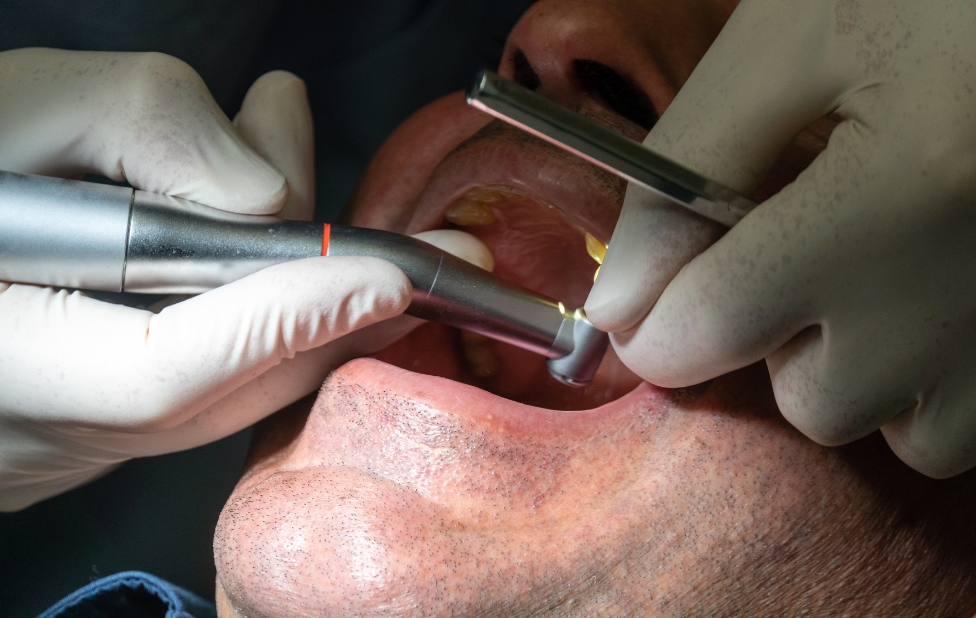 The Disparities in Access to Dental Implants in Morocco