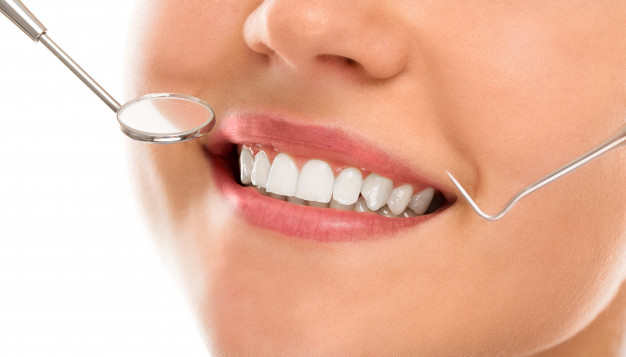 Soins dentaires au Maroc : prendre soin de ses dents pour préserver ses implants